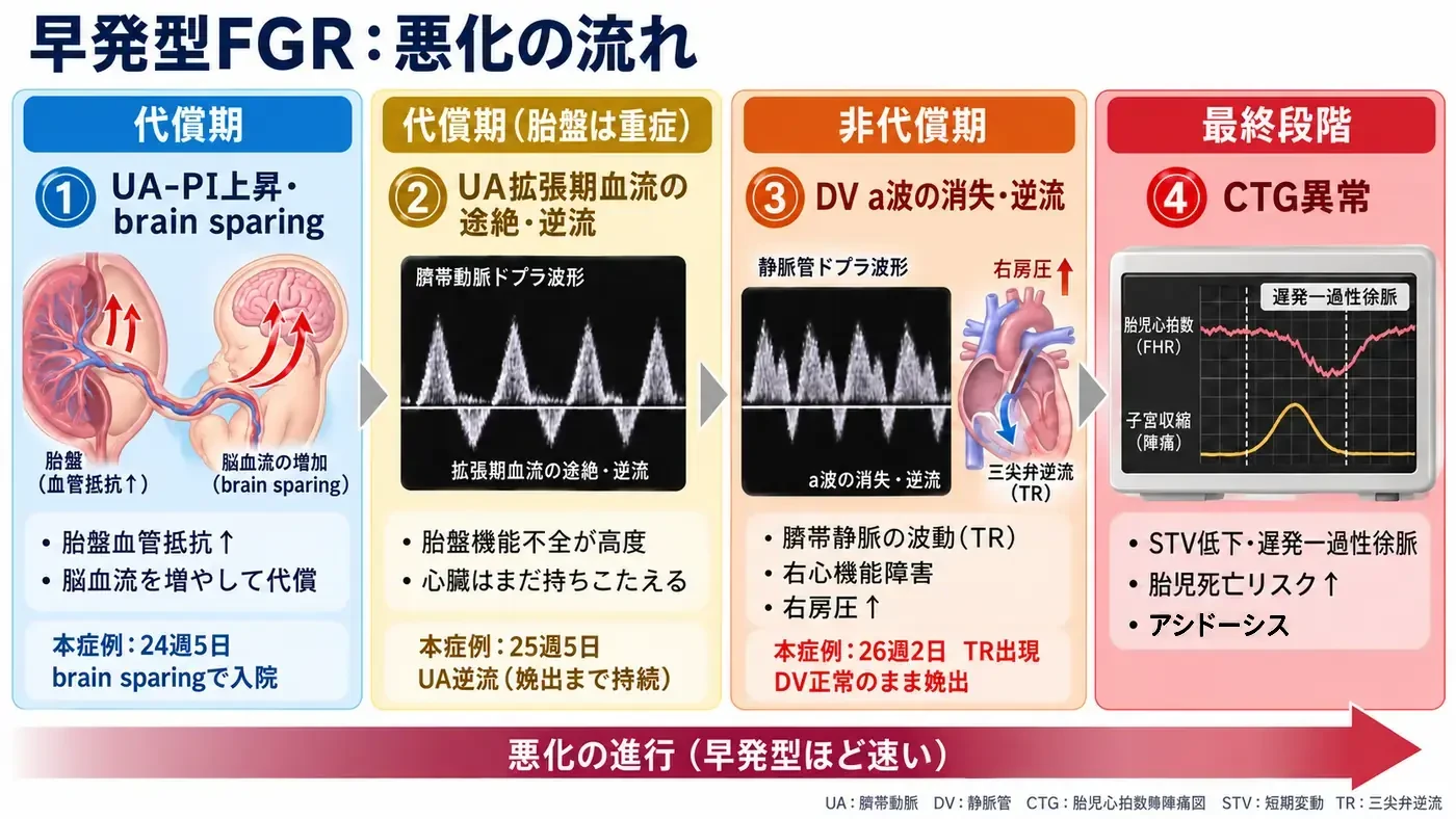 早発型FGR：悪化の流れ